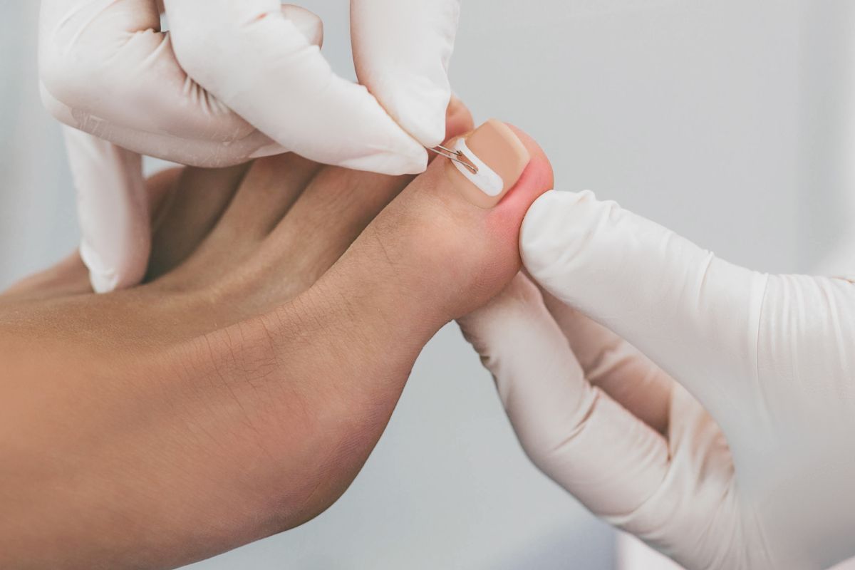 Pedicure podologiczny: czym różni się od zwykłego pedicure?